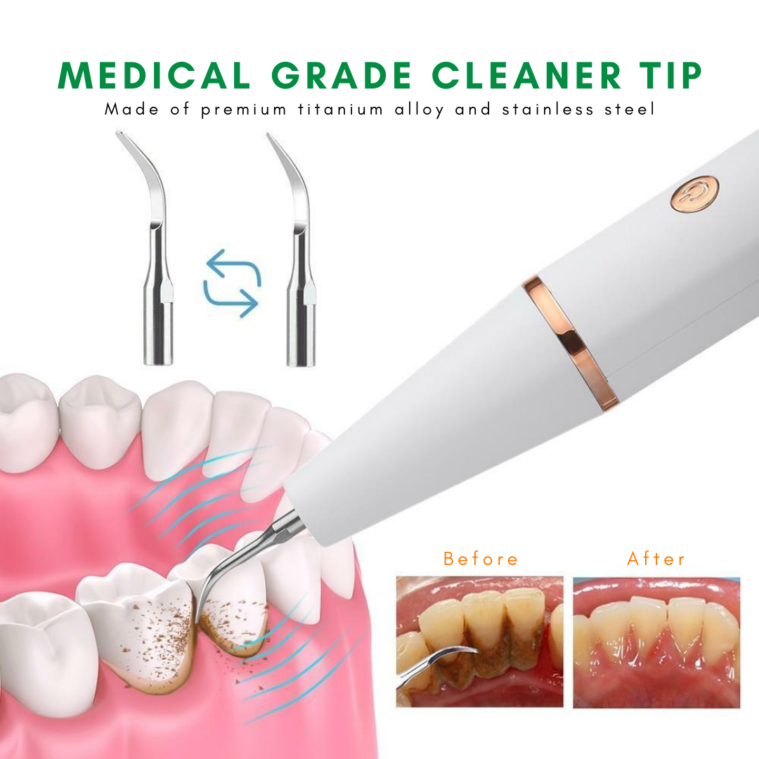 Irish Supply, CLEANSONIC, Revolutionary Ultrasonic Tartar Removal Tool