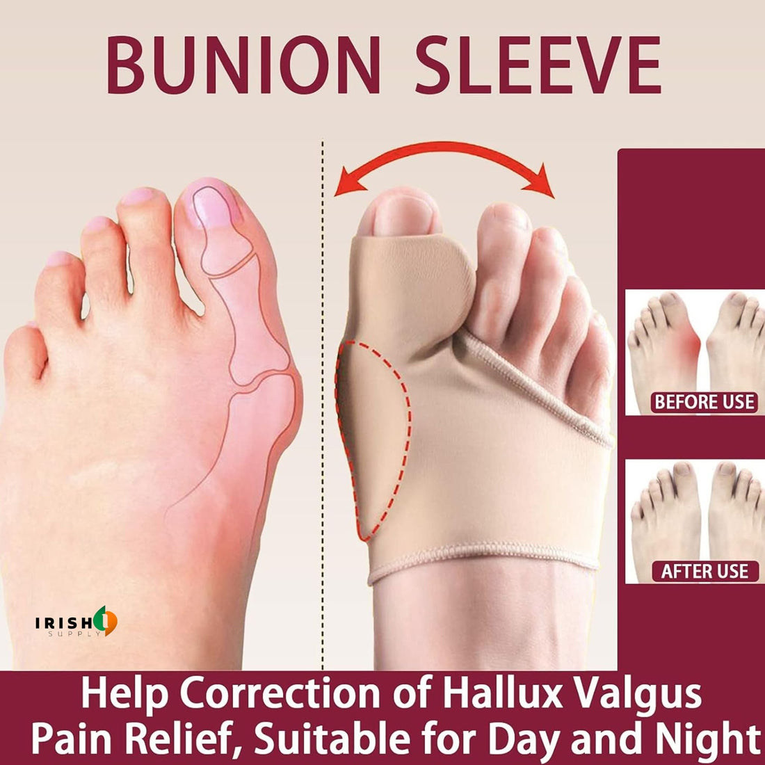 ORTHOSEAL Medical-Grade Foot Alignment Sleeve