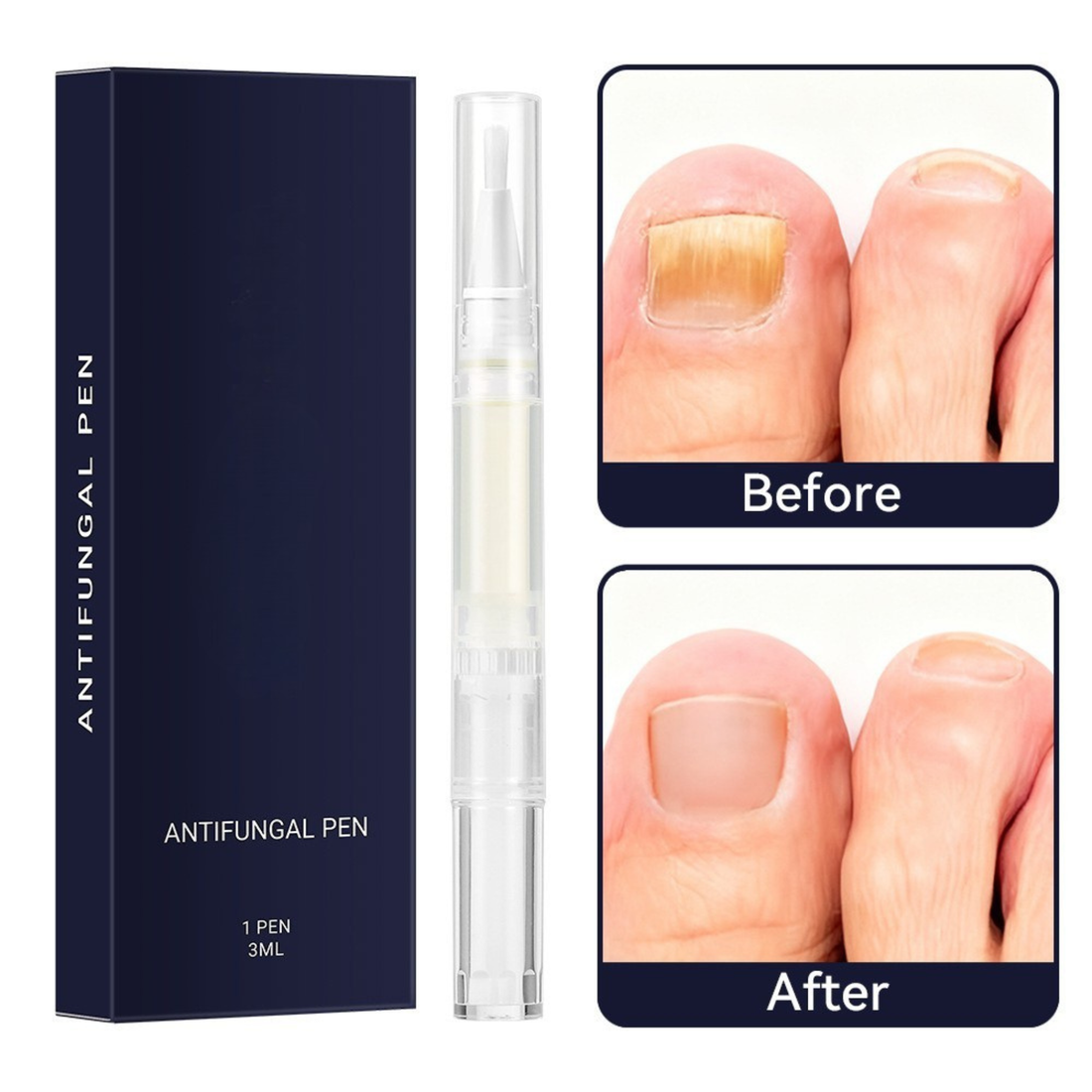 PUREFIX Deep Renewal Antifungal Treatment Pen