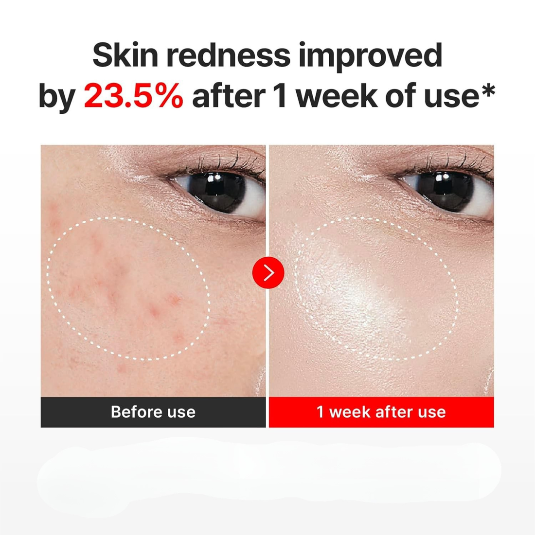 VAELORA Skin-Renewing Anti-Aging Cream with Cica & Hyaluronic Acid 50 ml
